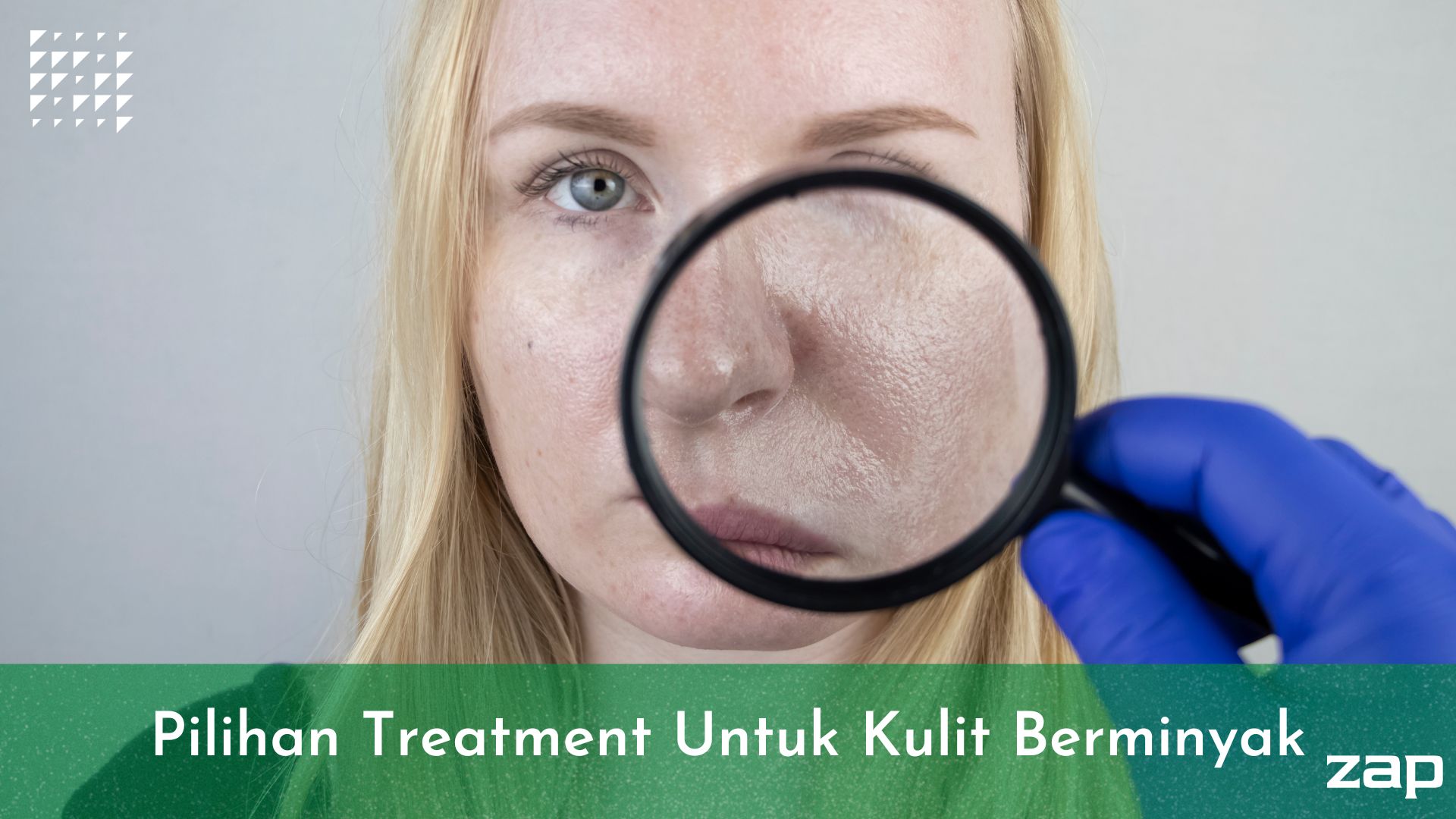Pilihan Treatment Untuk Kulit Berminyak