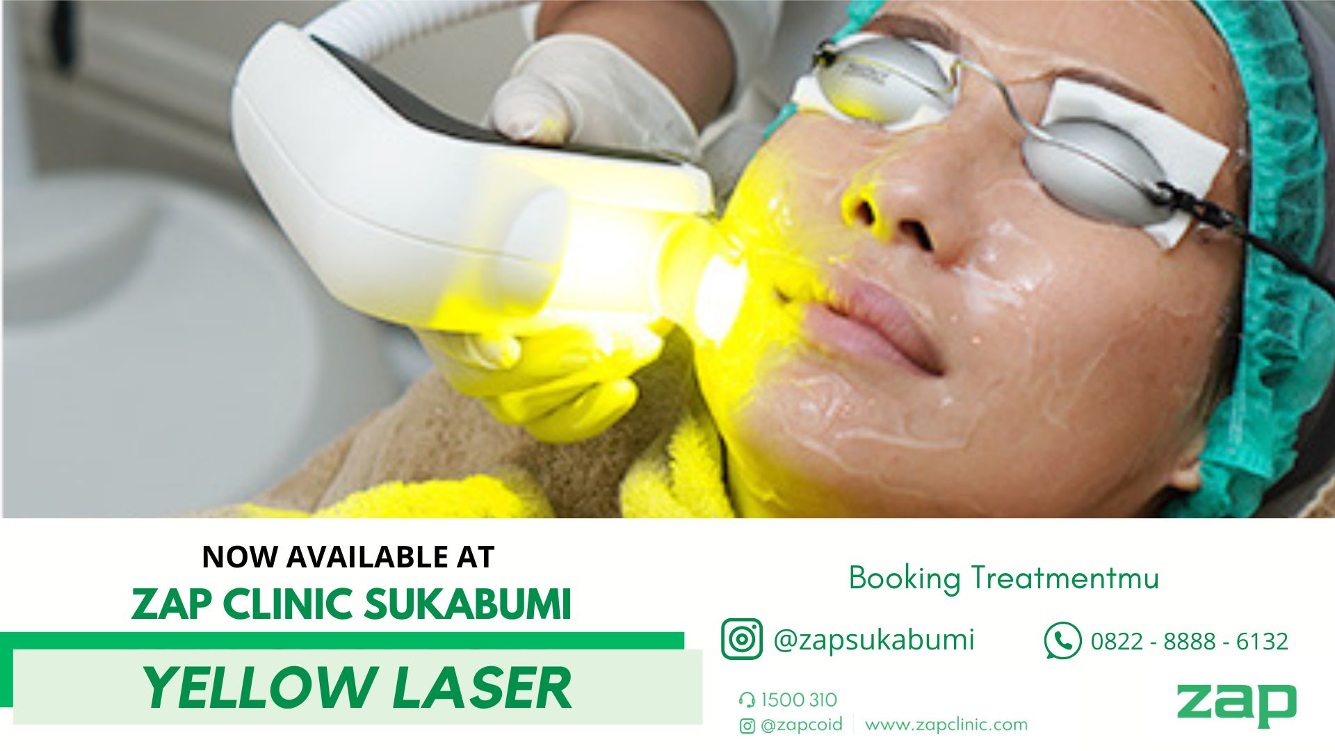 Yellow Laser Kini Tersedia di ZAP Sukabumi: Solusi Kulit Cerah & Glowing!