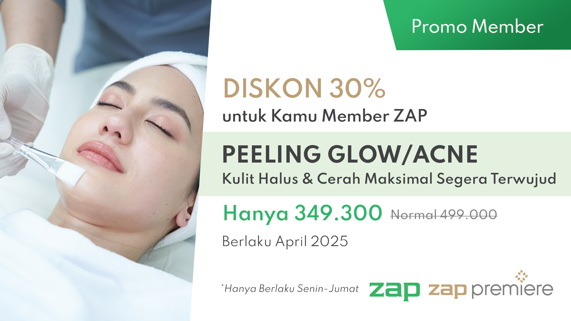 Treatment of The Month: Diskon 30% Treatment Chemical Peeling!