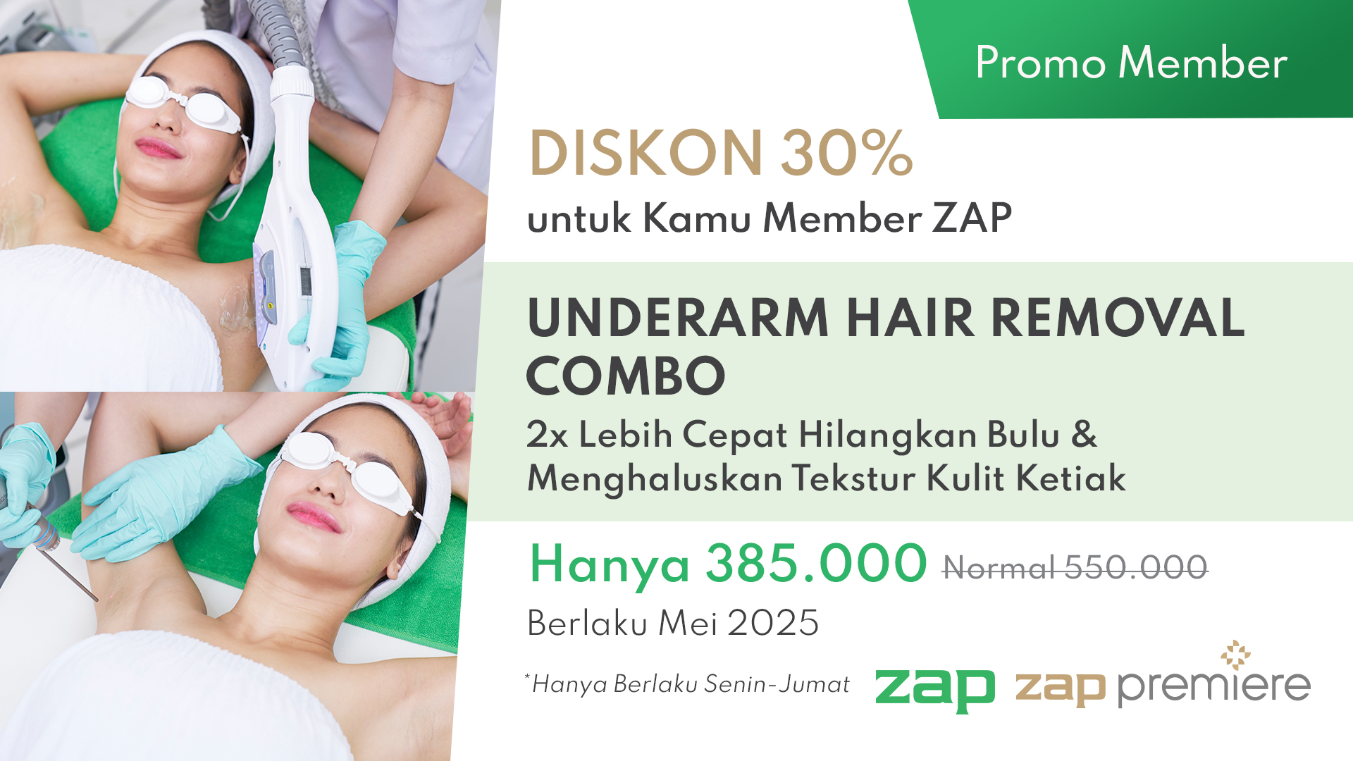 Underarm Hair Removal Discount 50% Khusus Member
