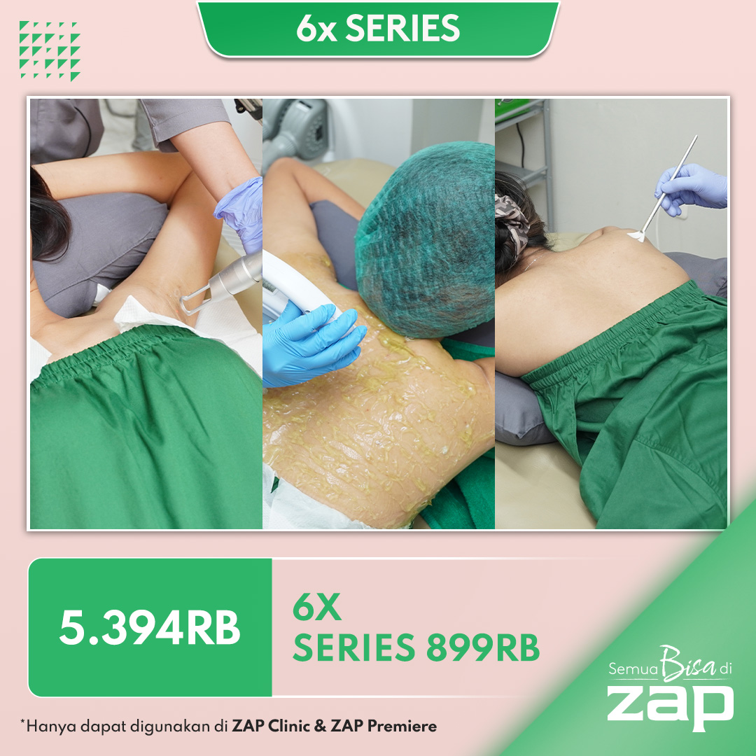 6X Series 899RB - Hair Removal & Body Treatment