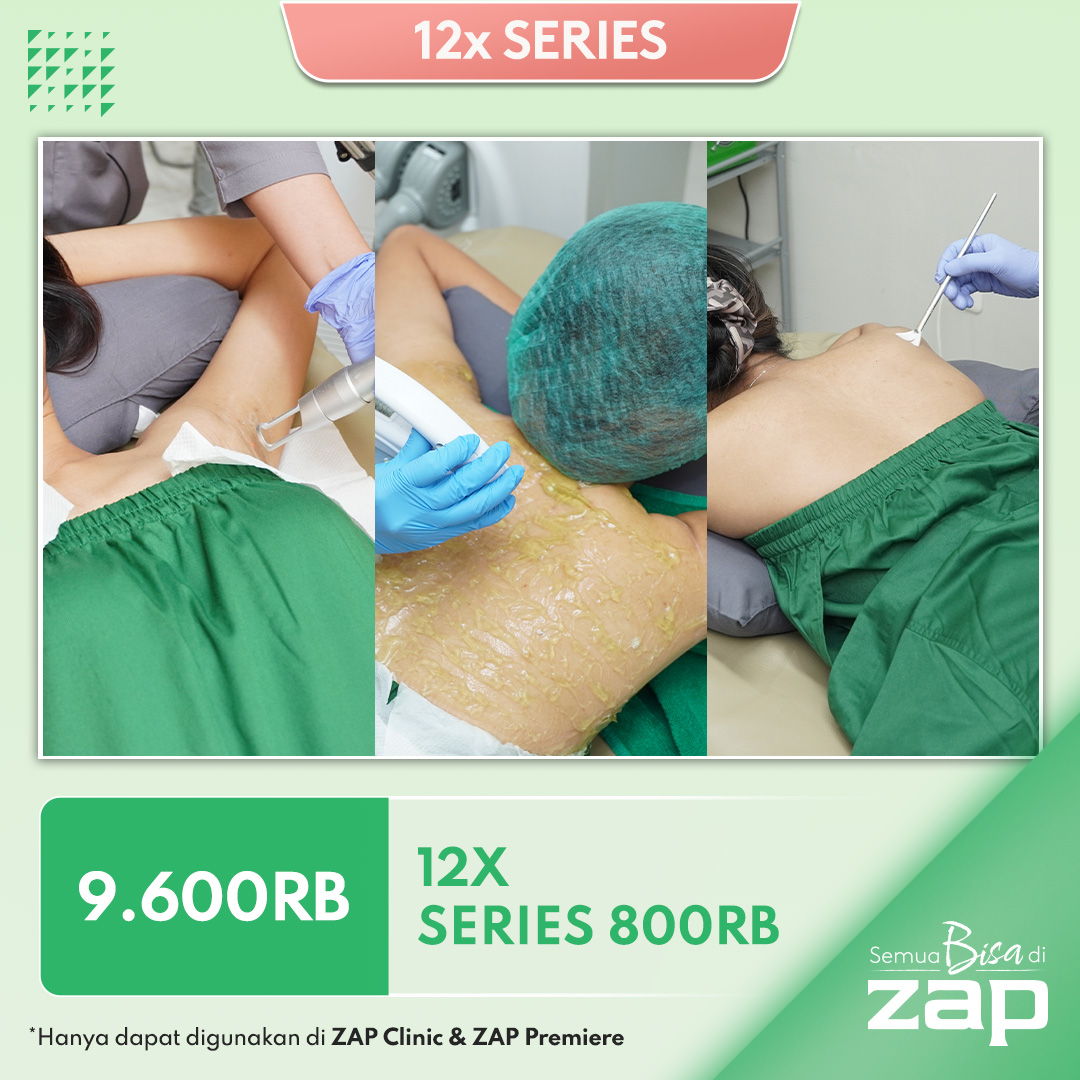 12X Series 800RB - Hair Removal & Body Treatment