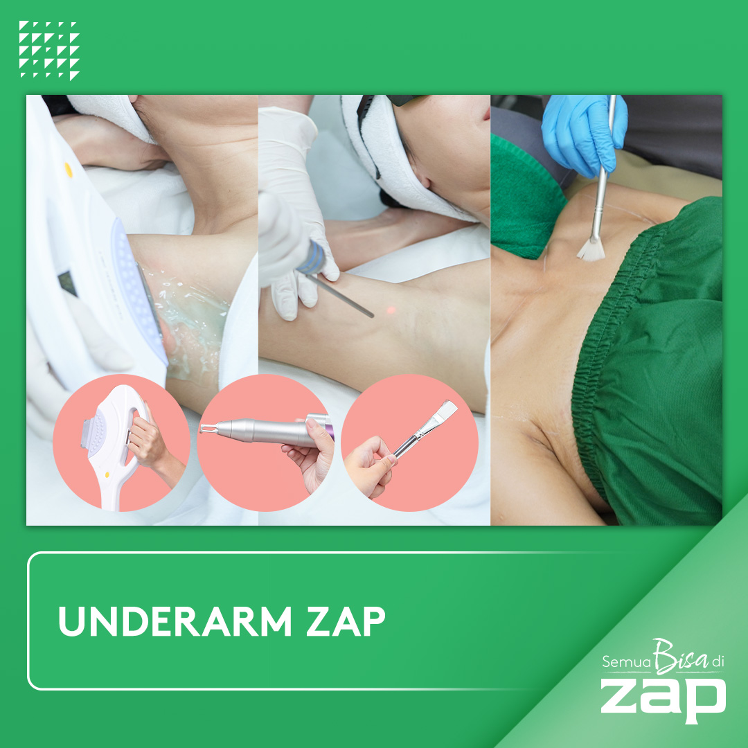 Underarm ZAP
