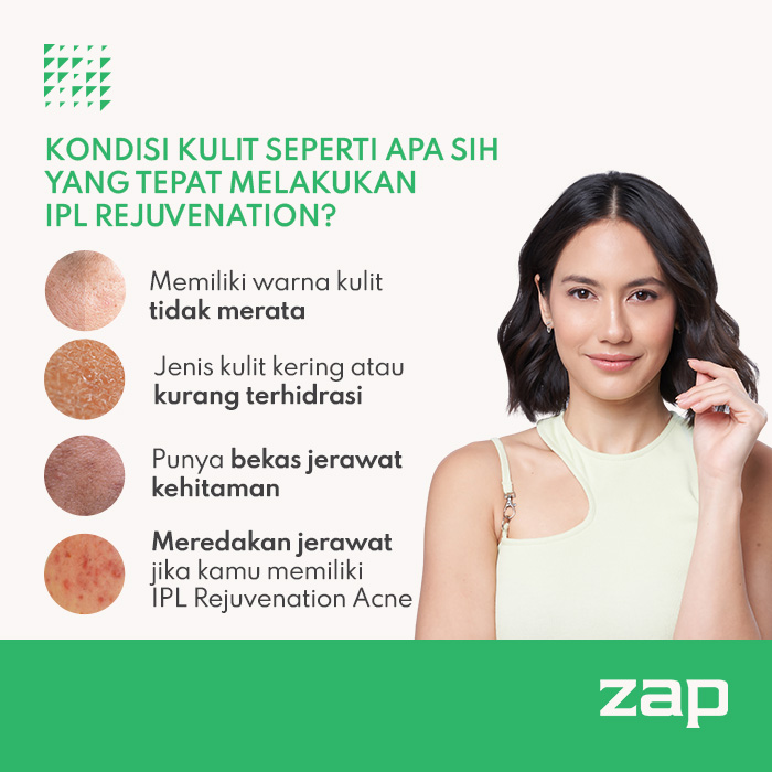 IPL Rejuvenation (125 Shot) ZAP