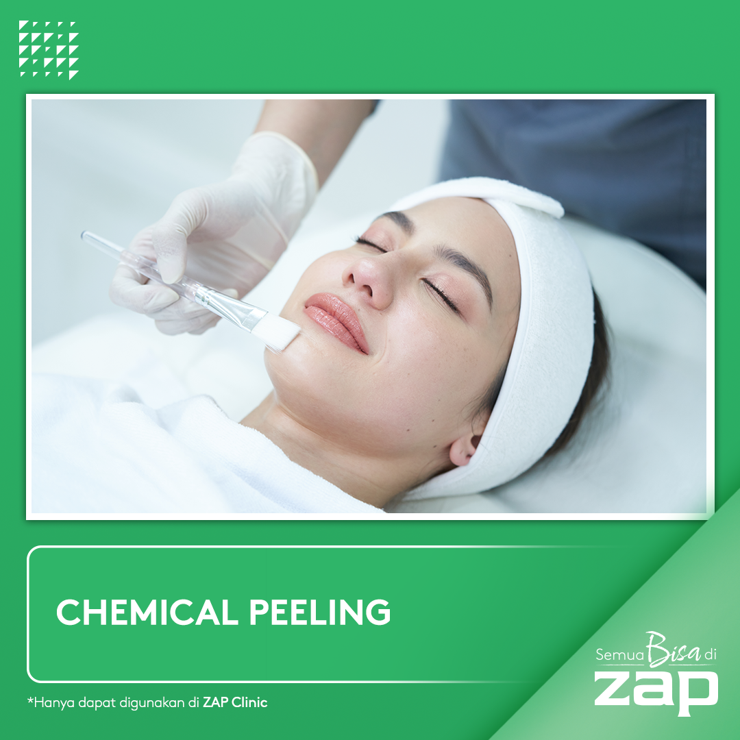 Chemical Peeling ZAP