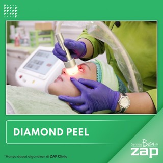 Diamond Peel ZAP