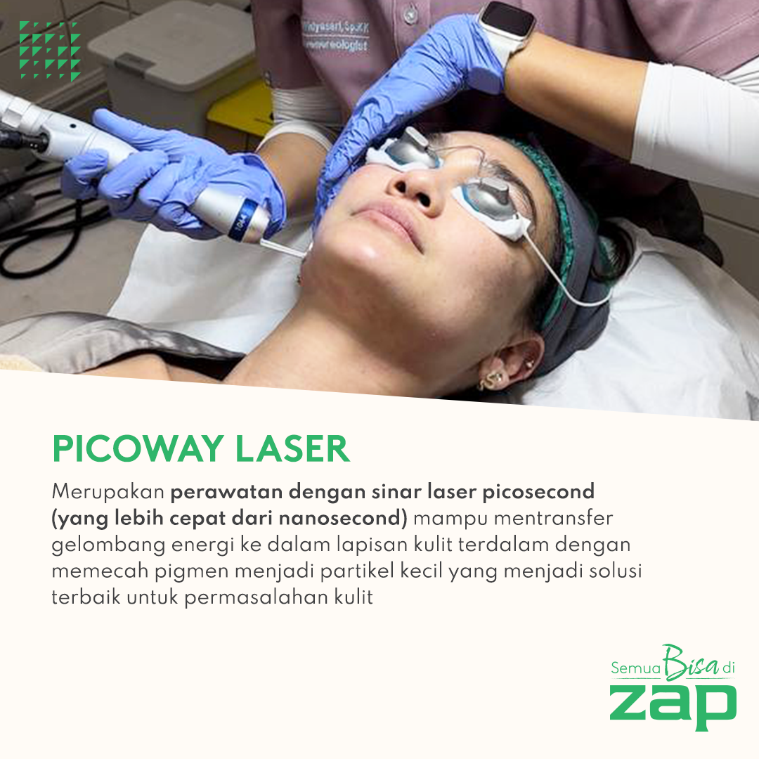 Picoway Laser ZAP