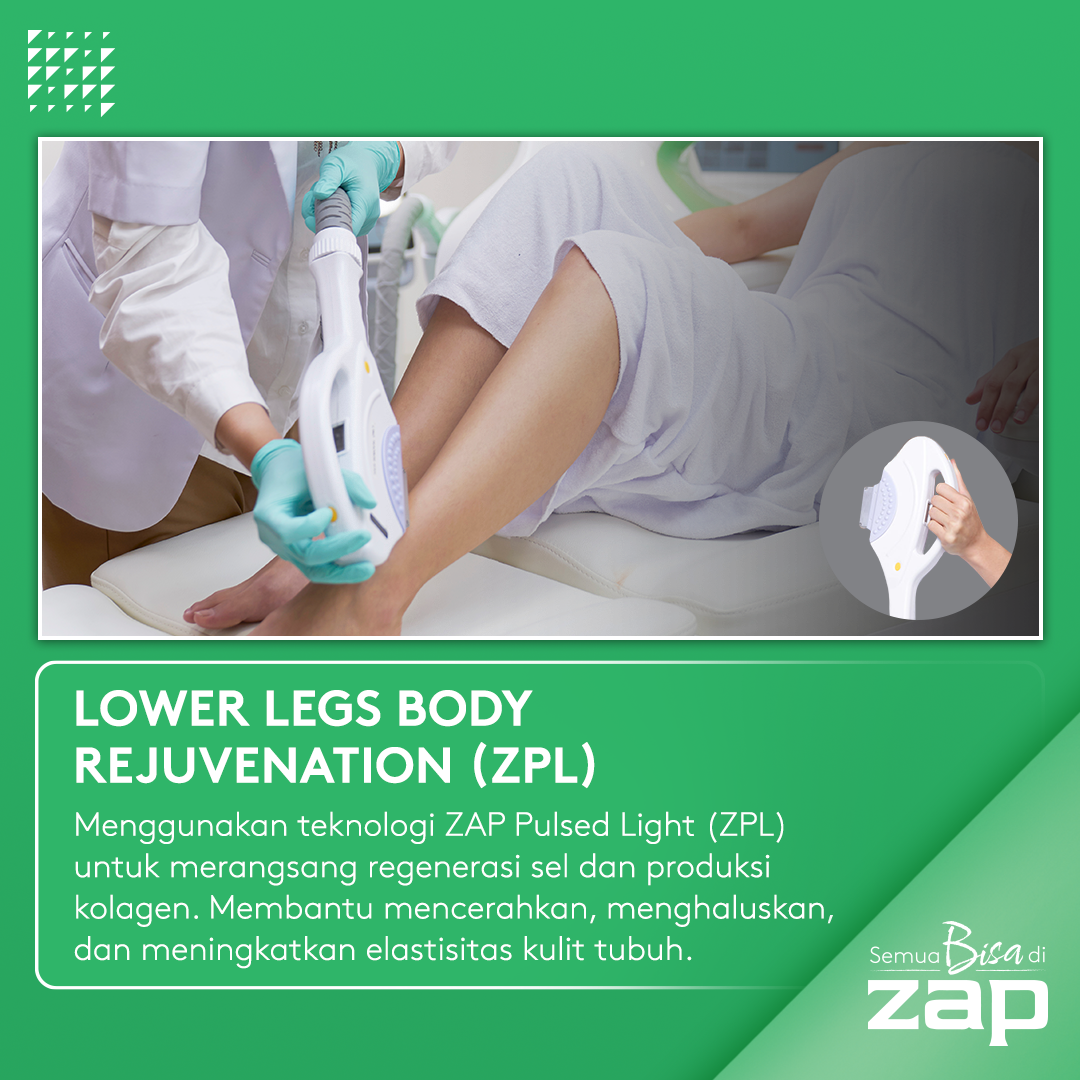 Lower Legs Rejuvenation - ZAP
