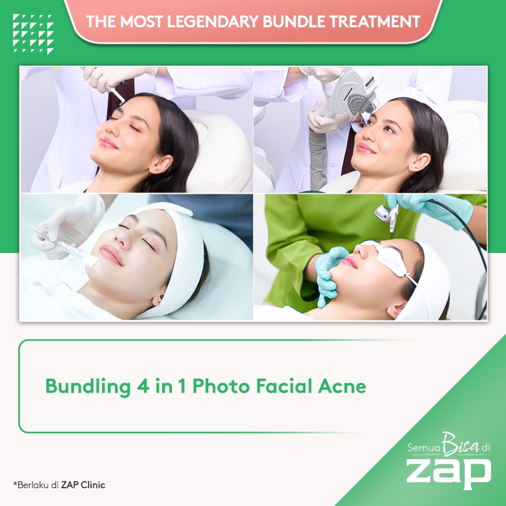 Basic Photo Facial Acne - Active Acne Laser + Laser Quasi Long Pulsed Acne + IPL Rejuvenation (125 shots) + Oxy Infusions