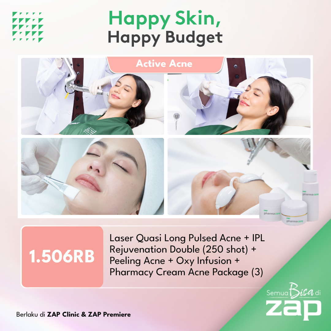 Laser Quasi Long Pulsed Acne + IPL Rejuvenation Double (250 shot) + Peeling Acne + Oxy Infusion + Pharmacy Cream Acne Package