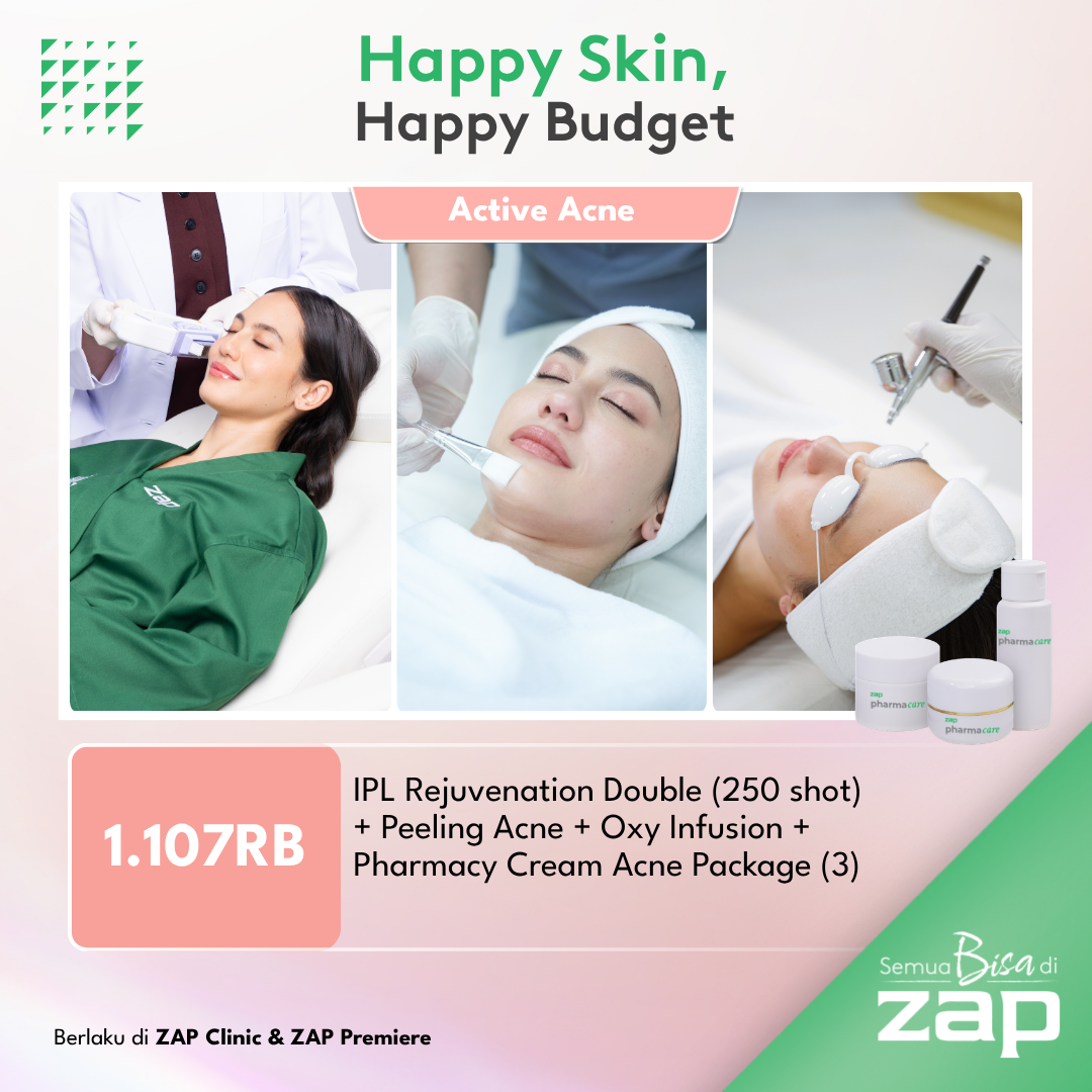 IPL Rejuvenation Double (250 shot) + Peeling Acne + Oxy Infusion + Pharmacy Cream Acne Package