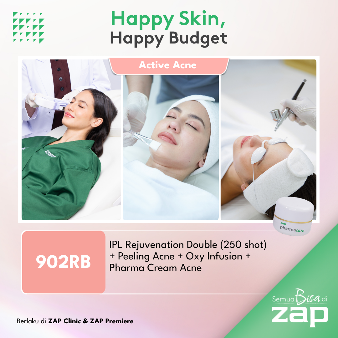 IPL Rejuvenation Double (250 shot) + Peeling Acne + Oxy Infusion + Pharma Cream Acne