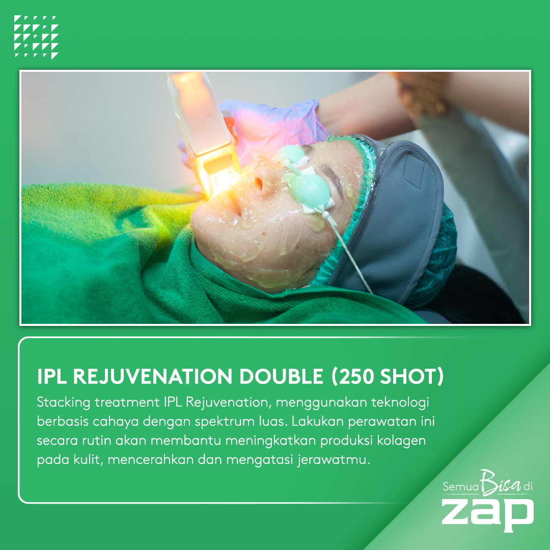 Facial Ekstraksi Advance Acne + IPL Rejuvenation Double Acne (250 shot) + Peeling Acne + Oxy Infusion + Pharma Cream Acne